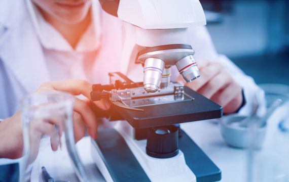 醫(yī)藥中間(jiān)體(tǐ)的(de)研究開(kāi)發